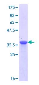 SDS-PAGE (NPHS1-6031H).jpg